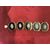 Bracciale 