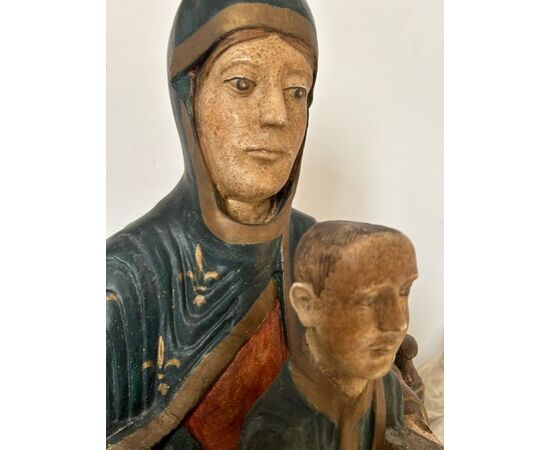 Plaster cast